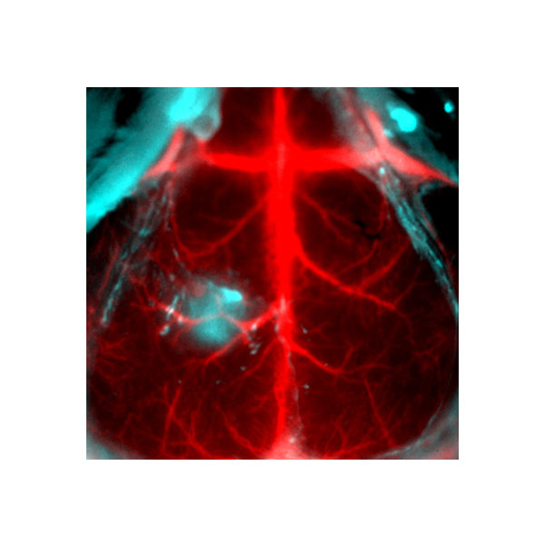 In Vivo Imaging